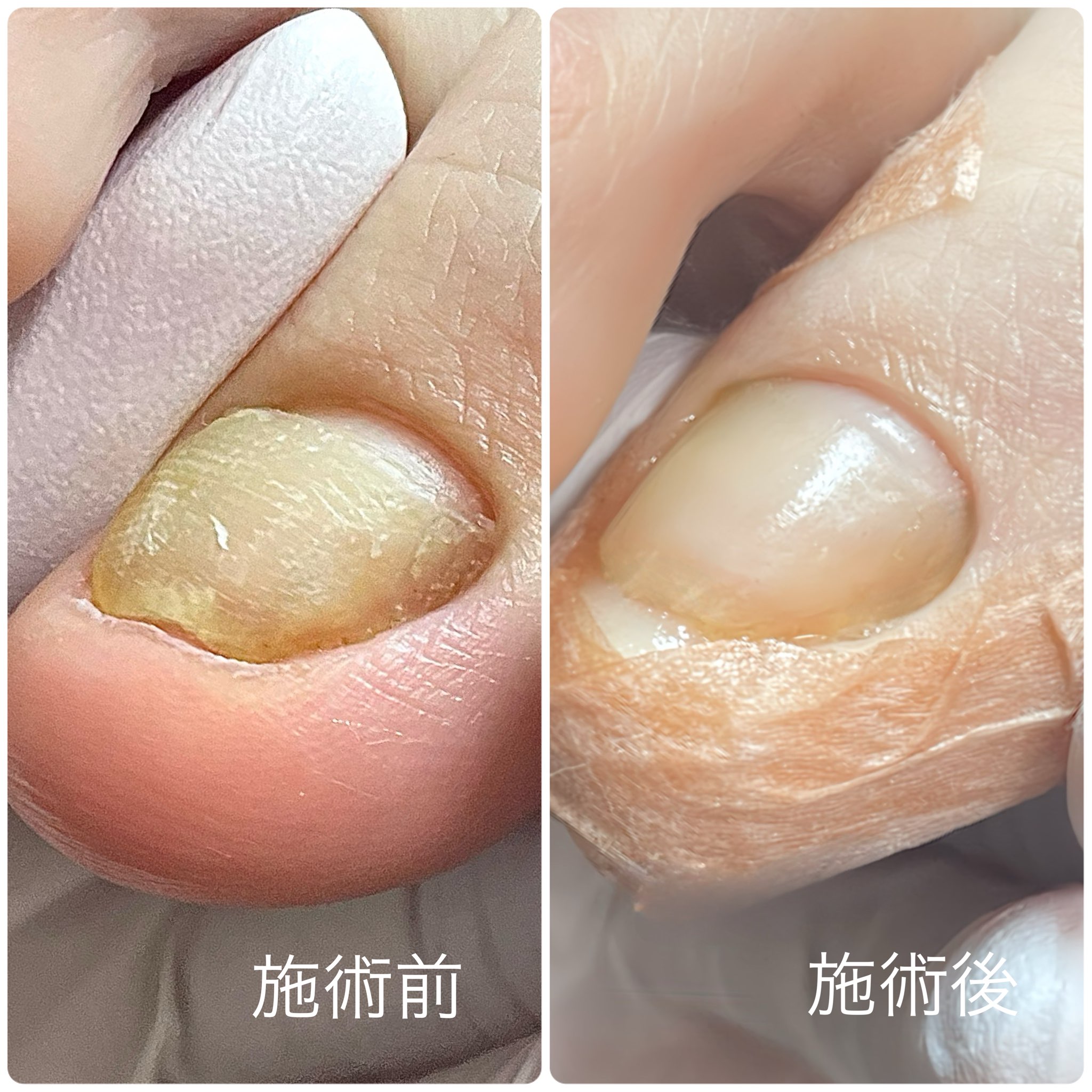 施術前・施術後 事例03