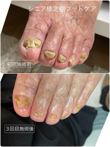 施術前・施術後 事例04