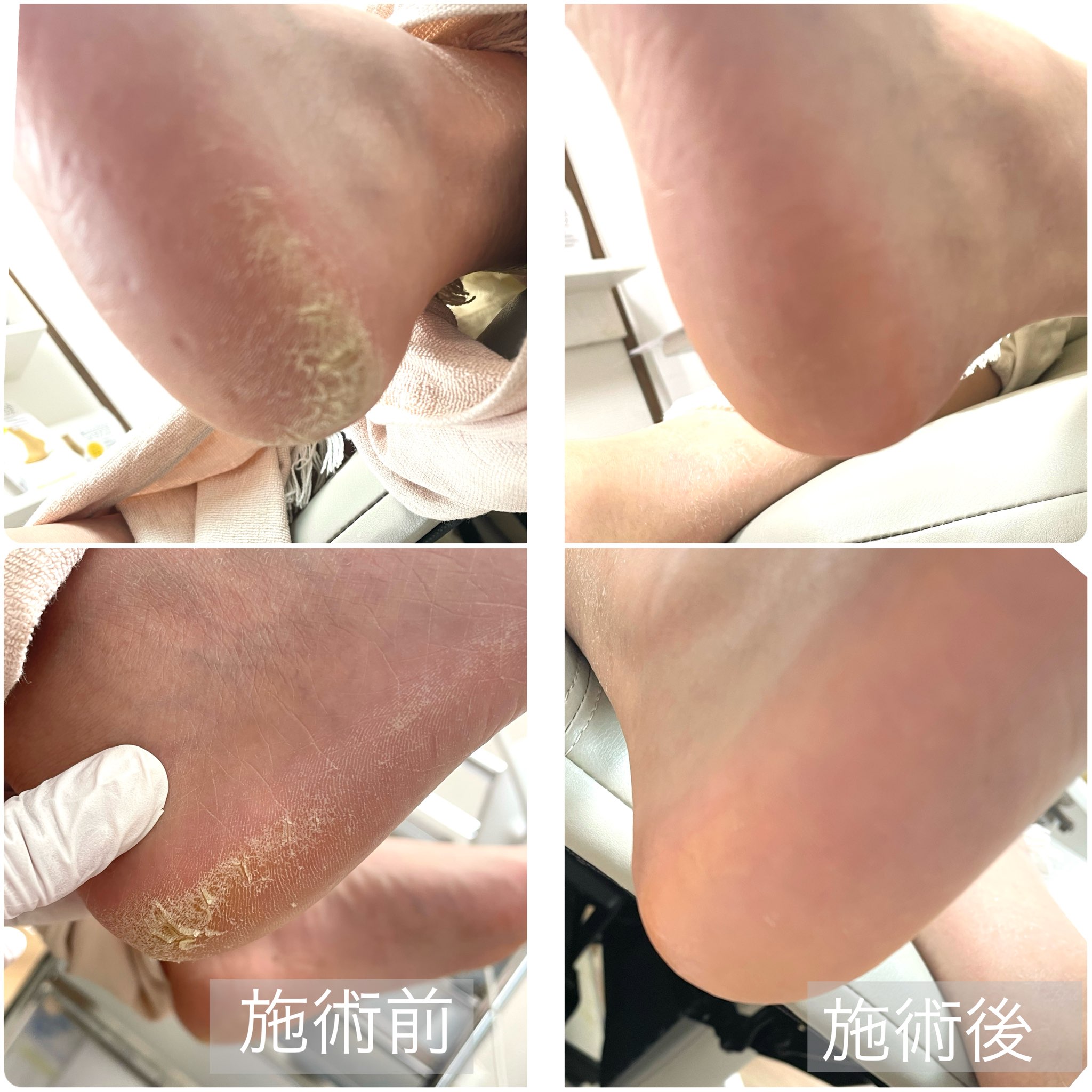 施術前・施術後 事例07