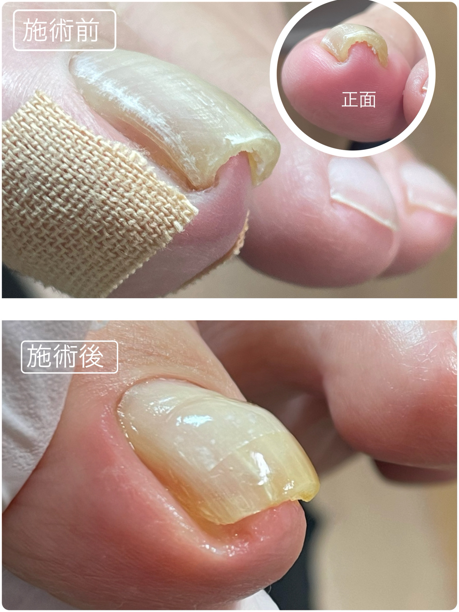 施術前・施術後 事例01