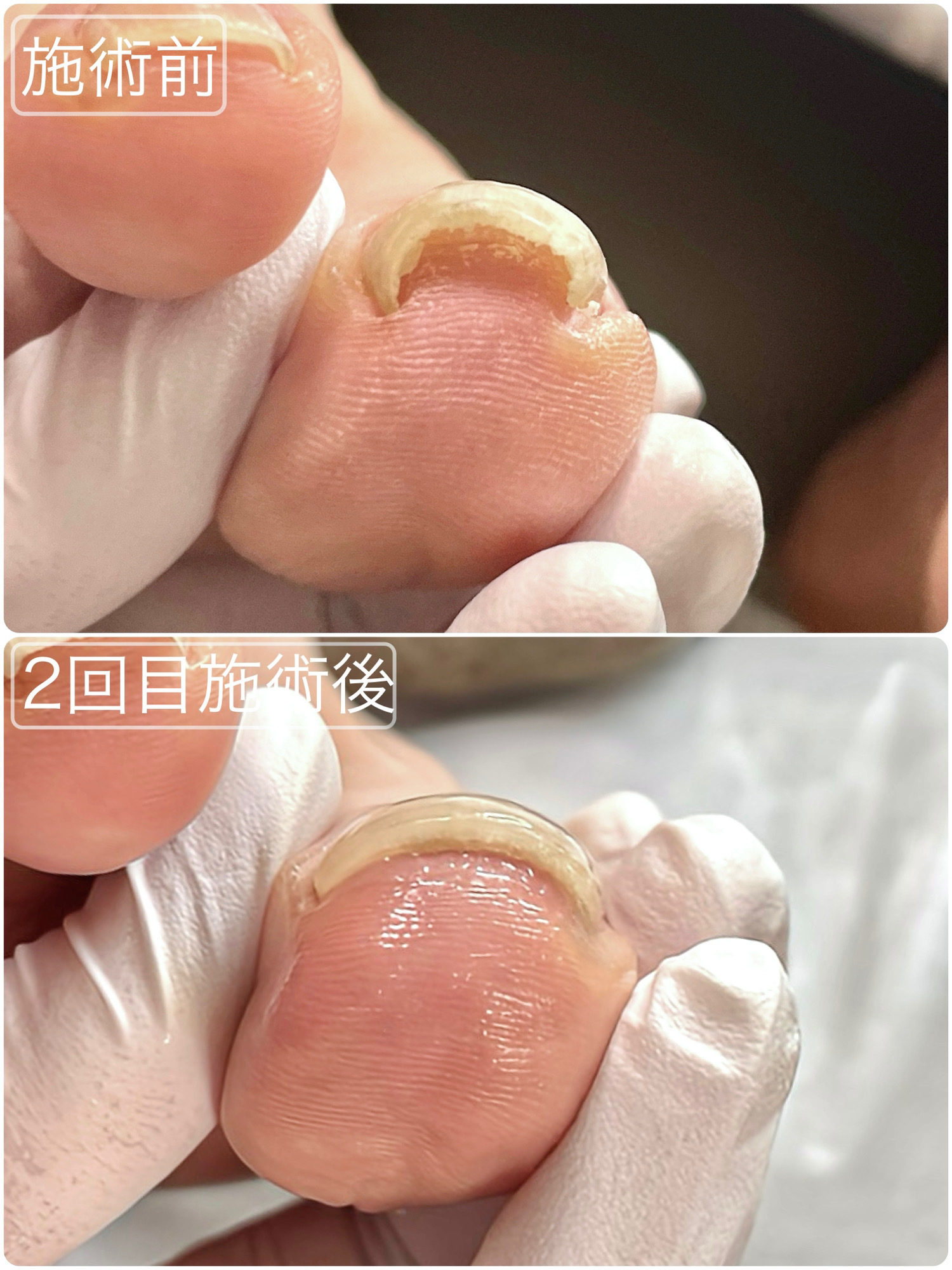 施術前・施術後 事例02