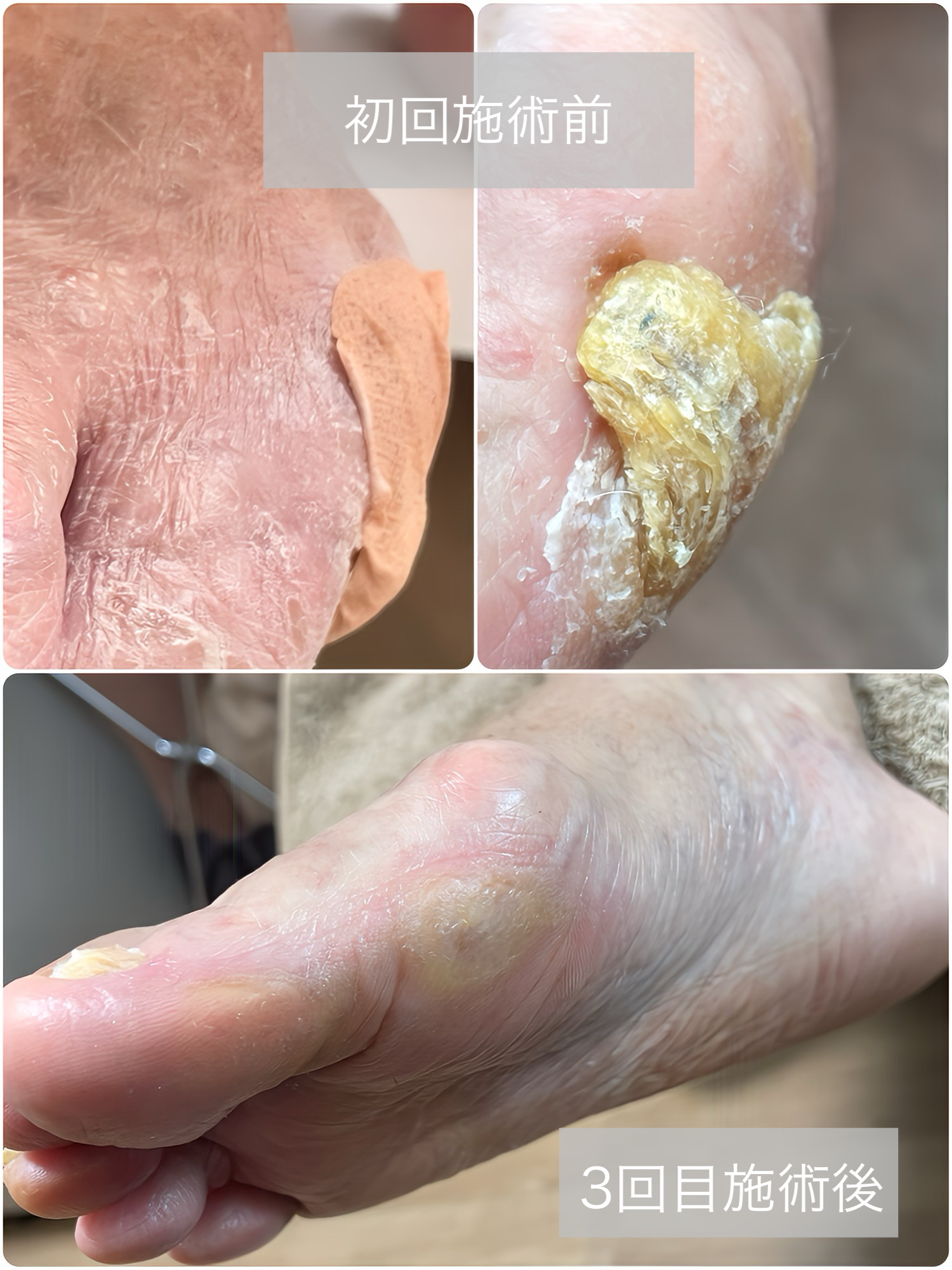 施術前・施術後 事例05