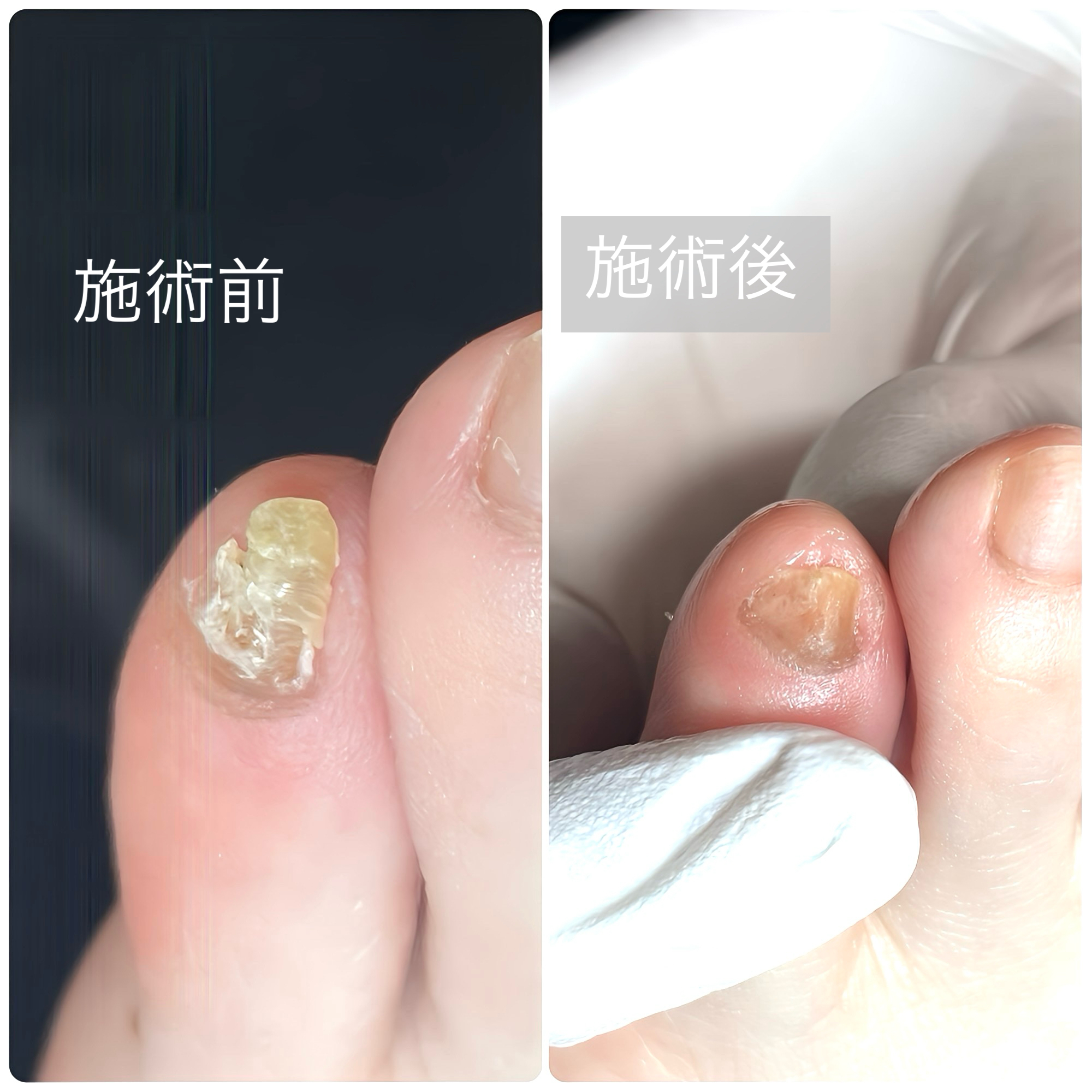 施術前・施術後 事例08