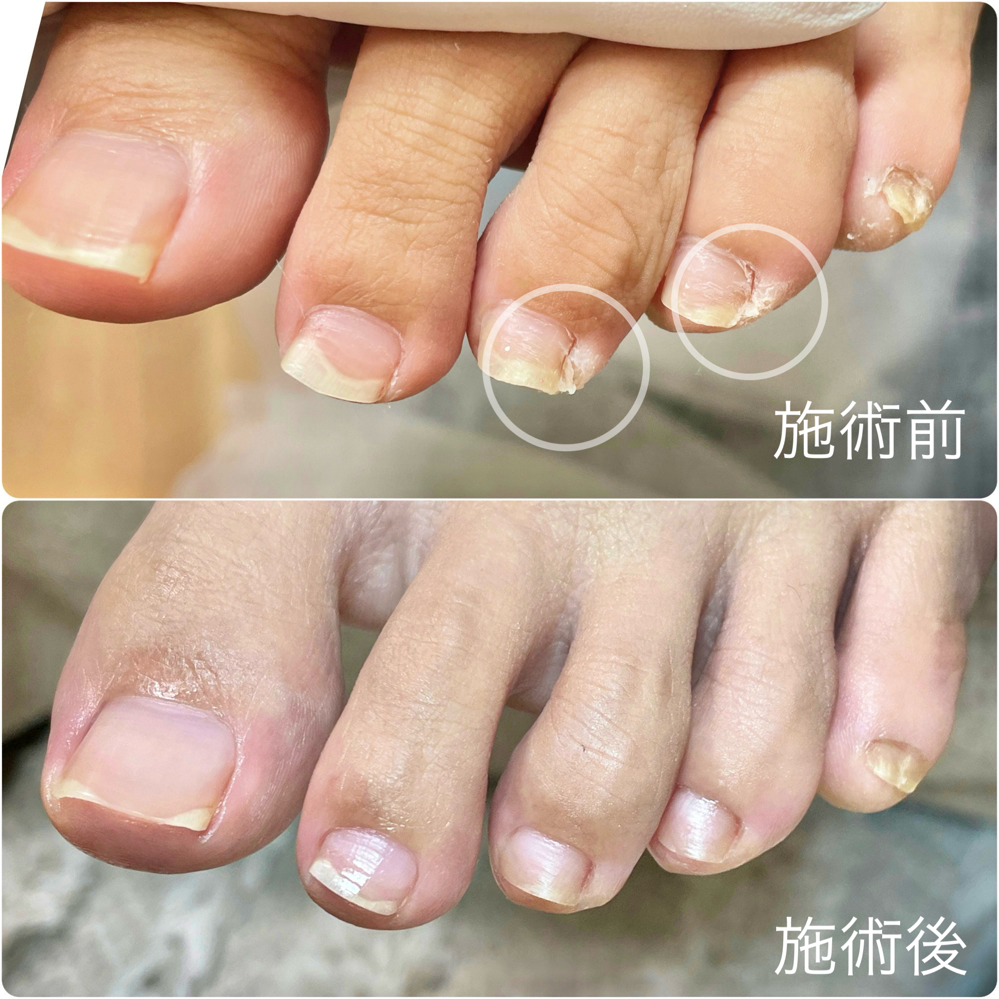 施術前・施術後 事例09